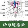 泌尿道感染